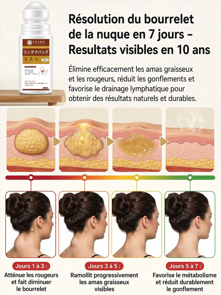 Boule Anti-Lipome – Aide à éliminer les Boules Sous la Peau naturellement