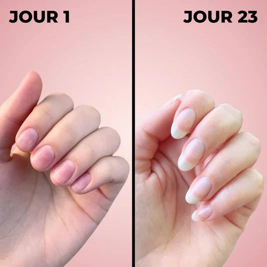 SÉRUM DE CROISSANCE DES ONGLES (1 ACHETÉ = 1 OFFERT)