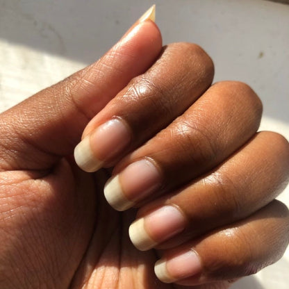 SÉRUM DE CROISSANCE DES ONGLES (1 ACHETÉ = 1 OFFERT)