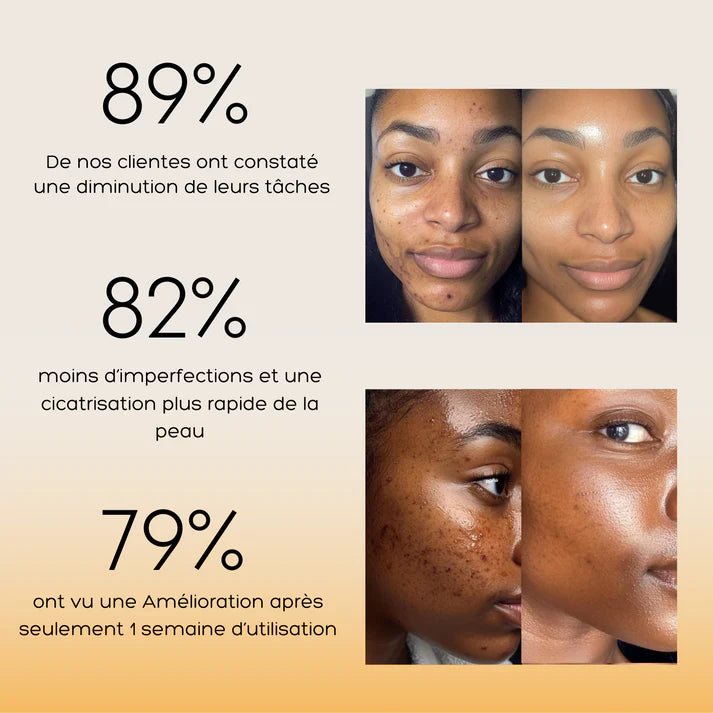 Routine Anti-imperfection 4 en 1 (1 ACHETÉ = 1 OFFERT)