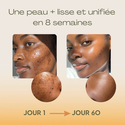 Routine Anti-imperfection 4 en 1 (1 ACHETÉ = 1 OFFERT)