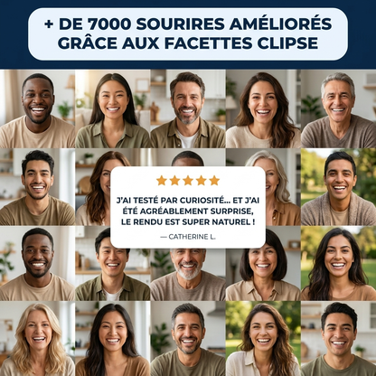Facettes dentaires