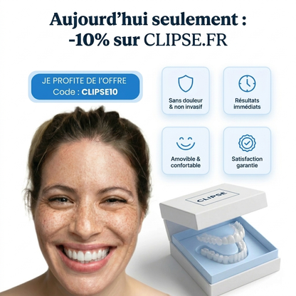 Facettes dentaires
